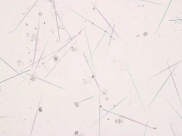 Спикулы