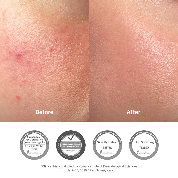 Pielea înainte și după utilizarea Dr. Althea 345 Relief Cream: roșeața s-a redus, confirmat clinic